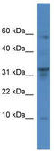 Dipeptidyl peptidase 1 antibody, TA342846, Origene, Western Blot image 