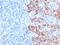 Keratin 10 antibody, NBP2-48219, Novus Biologicals, Immunohistochemistry paraffin image 