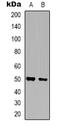 Zinc Finger Protein 436 antibody, LS-C368846, Lifespan Biosciences, Western Blot image 