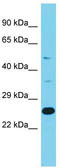 NCK Interacting Protein With SH3 Domain antibody, TA342637, Origene, Western Blot image 