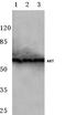 Protein kinase B antibody, AP06489PU-N, Origene, Western Blot image 