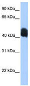 MyoD Family Inhibitor Domain Containing antibody, TA339838, Origene, Western Blot image 