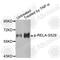 p65 antibody, AP0215, ABclonal Technology, Western Blot image 