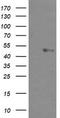 U-Box Domain Containing 5 antibody, TA503255, Origene, Western Blot image 