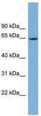 Rac GTPase-activating protein 1 antibody, TA330619, Origene, Western Blot image 