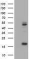 Ubiquinol-Cytochrome C Reductase Core Protein 1 antibody, TA800070BM, Origene, Western Blot image 