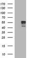 Matrix Metallopeptidase 13 antibody, TA506697, Origene, Western Blot image 