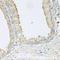 Progressive ankylosis protein homolog antibody, A03721, Boster Biological Technology, Immunohistochemistry frozen image 
