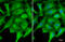 Polyribonucleotide Nucleotidyltransferase 1 antibody, GTX70159, GeneTex, Immunocytochemistry image 