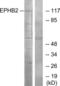 EPH Receptor B2 antibody, LS-C118850, Lifespan Biosciences, Western Blot image 