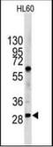 Lin-28 Homolog B antibody, orb88921, Biorbyt, Western Blot image 