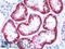 Large neutral amino acids transporter small subunit 2 antibody, LS-B9489, Lifespan Biosciences, Immunohistochemistry paraffin image 
