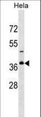 Golgi Phosphoprotein 3 Like antibody, LS-C159757, Lifespan Biosciences, Western Blot image 