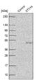 Serine/threonine-protein kinase 19 antibody, NBP1-84308, Novus Biologicals, Western Blot image 