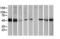 Protein kinase C and casein kinase substrate in neurons protein 3 antibody, LS-C172557, Lifespan Biosciences, Western Blot image 