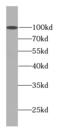 Dermatan Sulfate Epimerase antibody, FNab02543, FineTest, Western Blot image 