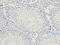 Probetacellulin antibody, LS-C335257, Lifespan Biosciences, Immunohistochemistry frozen image 