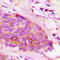 Synuclein Alpha antibody, LS-C358869, Lifespan Biosciences, Immunohistochemistry paraffin image 