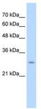 Ubiquitin-conjugating enzyme E2 J2 antibody, TA330495, Origene, Western Blot image 