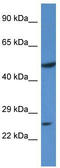 Krueppel-like factor 17 antibody, TA345593, Origene, Western Blot image 