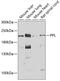 Periplakin antibody, GTX33403, GeneTex, Western Blot image 