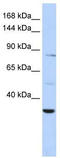 AHNAK Nucleoprotein 2 antibody, TA329530, Origene, Western Blot image 