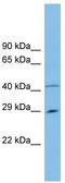 Chromosome 9 Open Reading Frame 152 antibody, TA342405, Origene, Western Blot image 