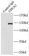 Cell Division Cycle Associated 2 antibody, FNab01539, FineTest, Immunoprecipitation image 