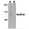 Platelet glycoprotein VI antibody, MBS150560, MyBioSource, Western Blot image 