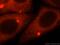 Autocrine motility factor receptor, isoform 1 antibody, 16675-1-AP, Proteintech Group, Immunofluorescence image 