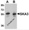Spindle and kinetochore-associated protein 3 antibody, 5405, ProSci, Western Blot image 