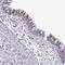 Abhydrolase Domain Containing 17A antibody, NBP2-31029, Novus Biologicals, Immunohistochemistry paraffin image 