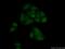LSM5 Homolog, U6 Small Nuclear RNA And MRNA Degradation Associated antibody, 10700-1-AP, Proteintech Group, Immunofluorescence image 