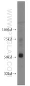 ADP Dependent Glucokinase antibody, 15639-1-AP, Proteintech Group, Western Blot image 