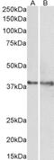 Cannabinoid Receptor 1 antibody, 42-367, ProSci, Enzyme Linked Immunosorbent Assay image 