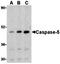 ATP Binding Cassette Subfamily C Member 5 antibody, orb19895, Biorbyt, Western Blot image 