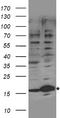 Ubiquitin Conjugating Enzyme E2 N Like (Gene/Pseudogene) antibody, TA890155, Origene, Western Blot image 