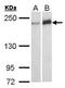 Werner syndrome ATP-dependent helicase antibody, GTX101082, GeneTex, Western Blot image 