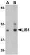 Platelet-activating factor acetylhydrolase IB subunit alpha antibody, TA306455, Origene, Western Blot image 