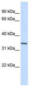 Glucosamine-6-Phosphate Deaminase 1 antibody, TA346600, Origene, Western Blot image 