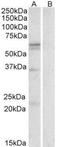 Solute Carrier Family 7 Member 5 antibody, NBP1-51935, Novus Biologicals, Western Blot image 