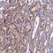 DIS3 Like Exosome 3'-5' Exoribonuclease antibody, HPA041805, Atlas Antibodies, Immunohistochemistry paraffin image 