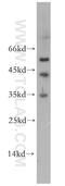 SCP 2 antibody, 19182-1-AP, Proteintech Group, Western Blot image 