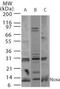 Phorbol-12-Myristate-13-Acetate-Induced Protein 1 antibody, GTX85836, GeneTex, Western Blot image 