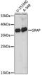 GRB2 Related Adaptor Protein antibody, A15391, ABclonal Technology, Western Blot image 
