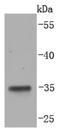 Lymphatic Vessel Endothelial Hyaluronan Receptor 1 antibody, NBP2-66940, Novus Biologicals, Western Blot image 