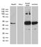 Homer protein homolog 1 antibody, M03877, Boster Biological Technology, Western Blot image 