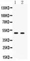 E2F Transcription Factor 3 antibody, LS-C313251, Lifespan Biosciences, Western Blot image 