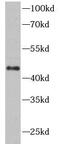 TNF Receptor Superfamily Member 10b antibody, FNab02530, FineTest, Western Blot image 