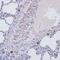 Perforin 1 antibody, GTX64408, GeneTex, Immunohistochemistry paraffin image 